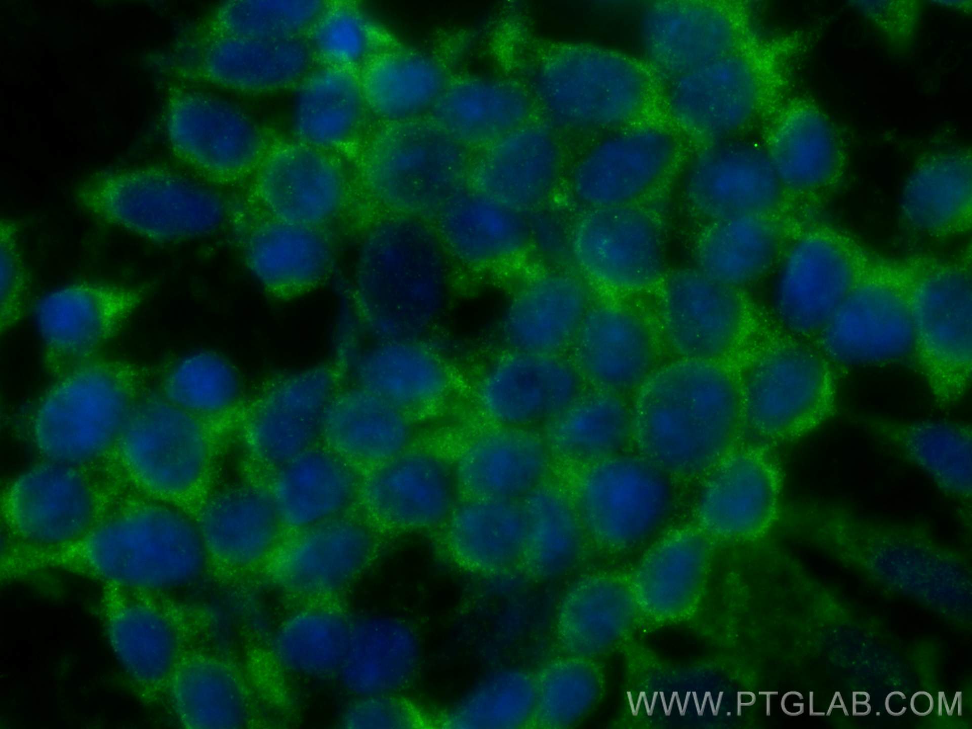 Immunofluorescence (IF) / fluorescent staining of SH-SY5Y cells using Alpha Synuclein Polyclonal antibody (10842-1-AP)