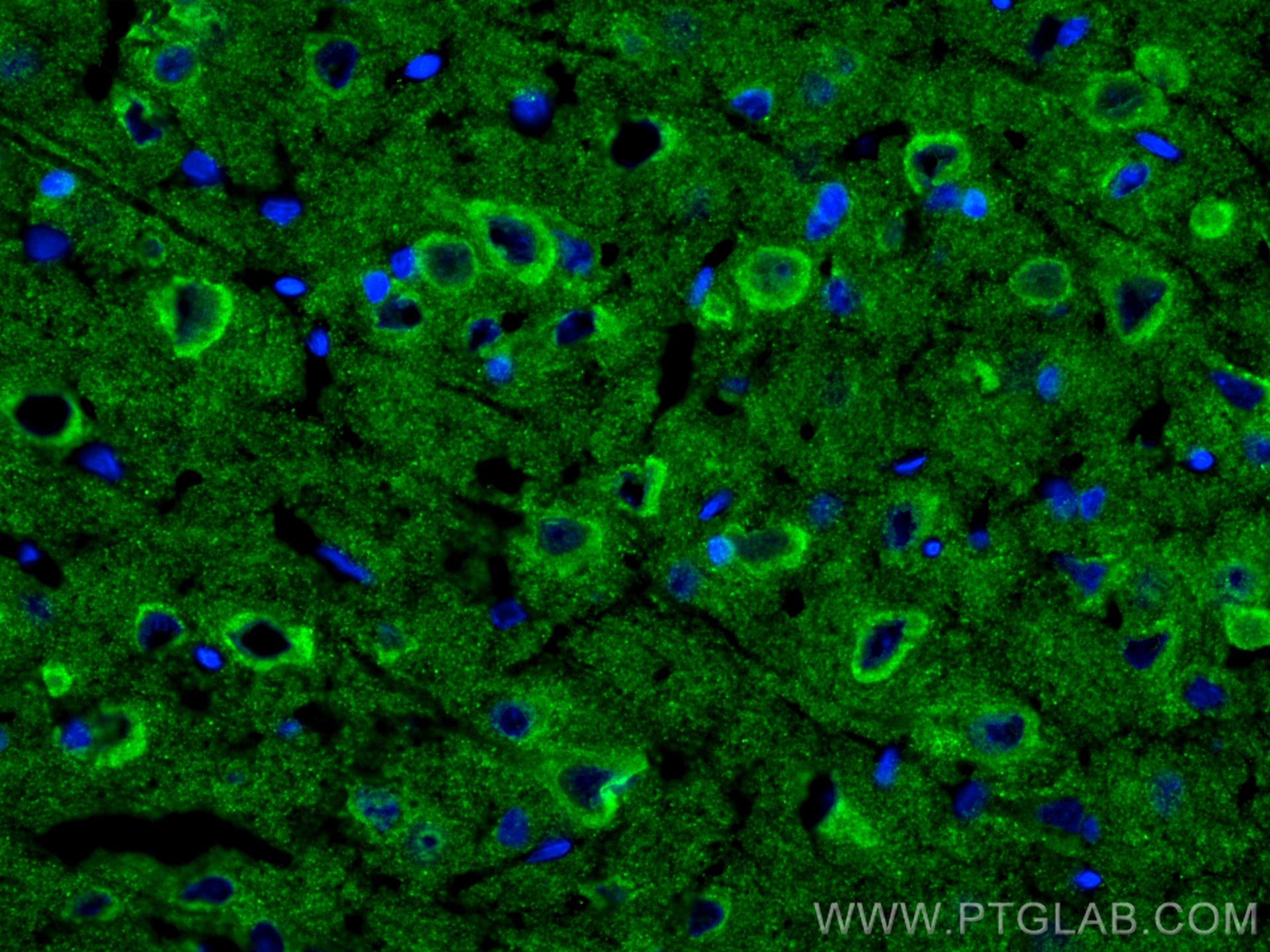 Immunofluorescence (IF) / fluorescent staining of rat brain tissue using Alpha Synuclein Polyclonal antibody (10842-1-AP)