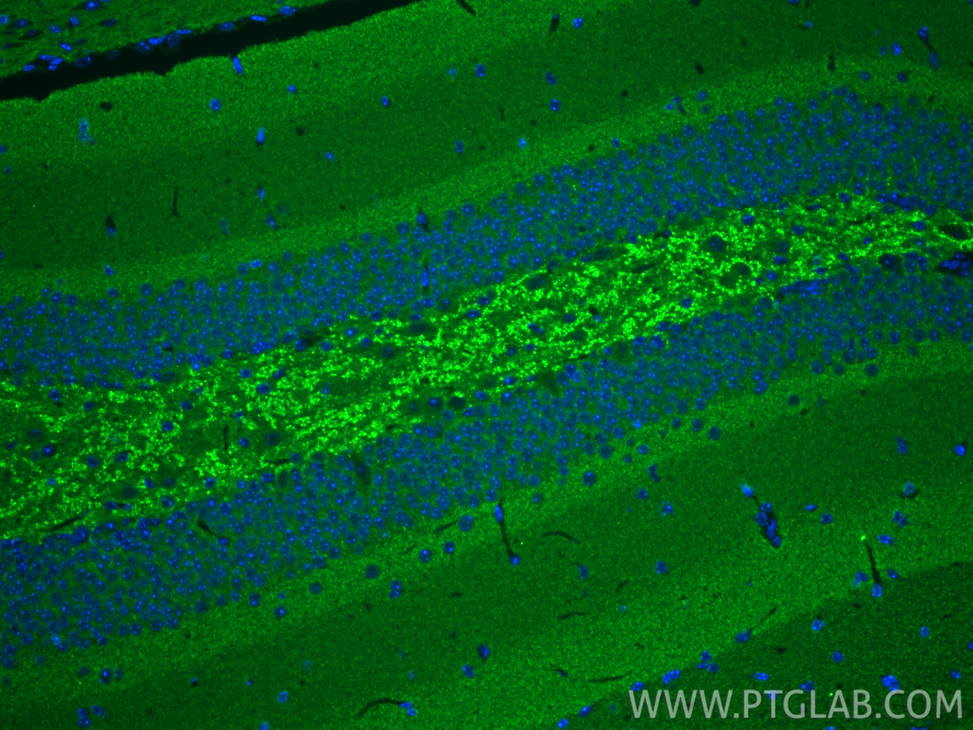 IF Staining of mouse brain using 10842-1-AP Immunofluorescence (IF) / fluorescent staining of mouse brain tissue using Alpha Synuclein Polyclonal antibody (10842-1-AP)
