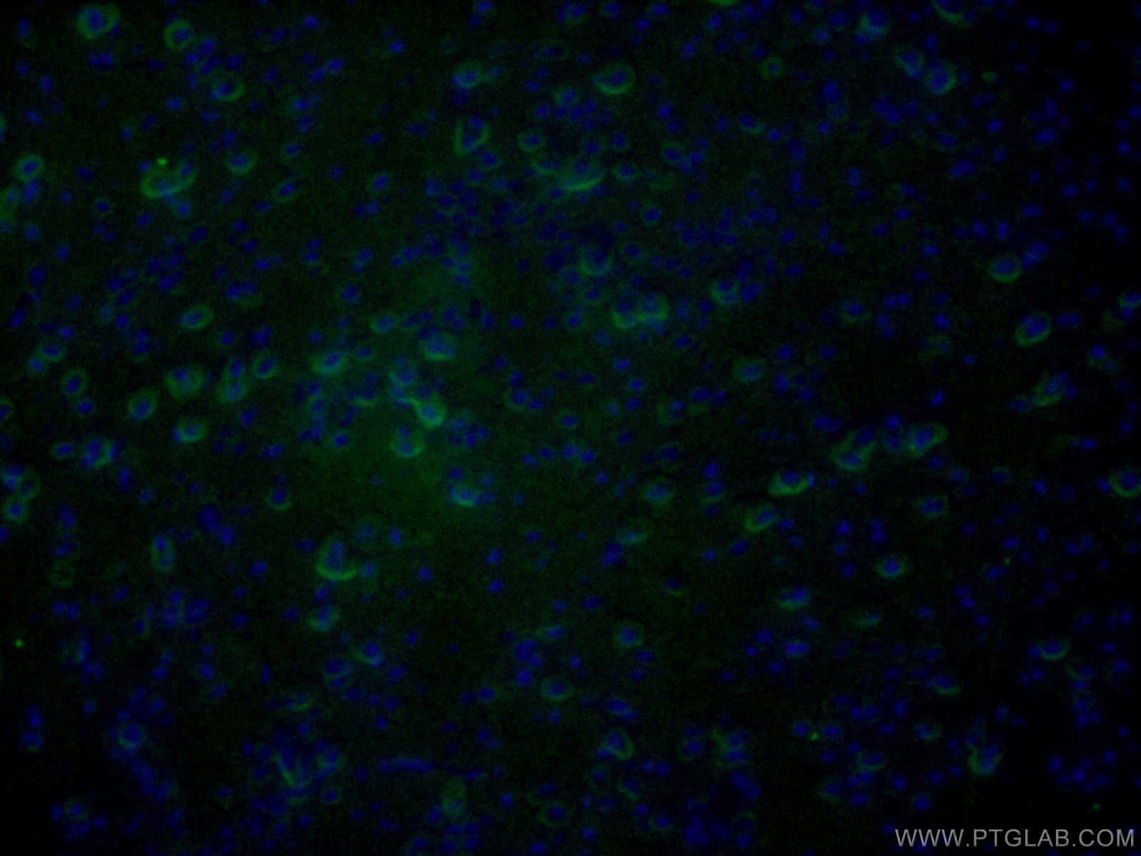IF Staining of mouse brain using 10842-1-AP
