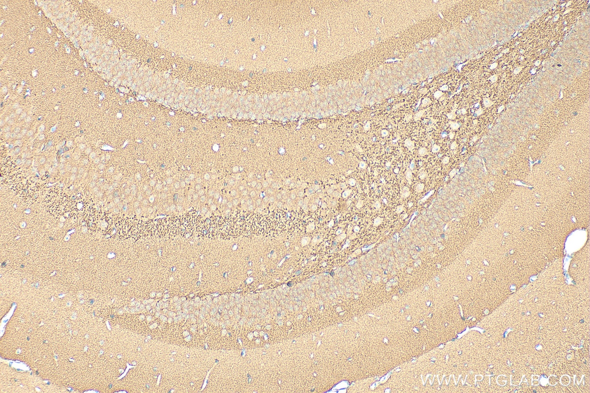 Immunohistochemistry (IHC) staining of mouse brain tissue using Alpha Synuclein Polyclonal antibody (10842-1-AP)