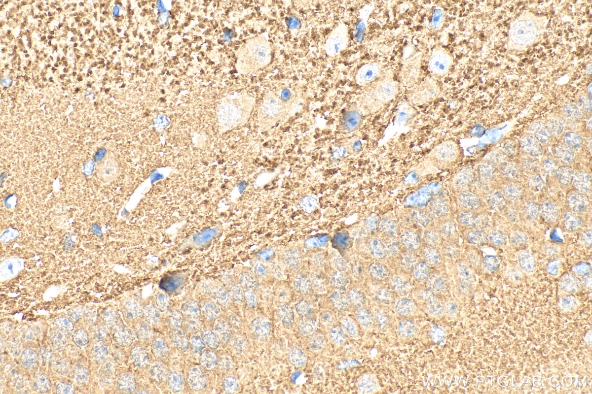 Immunohistochemistry (IHC) staining of mouse brain tissue using Alpha Synuclein Polyclonal antibody (10842-1-AP)