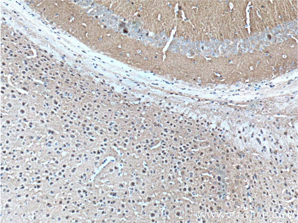 Immunohistochemistry (IHC) staining of mouse brain tissue using Alpha Synuclein Polyclonal antibody (10842-1-AP)