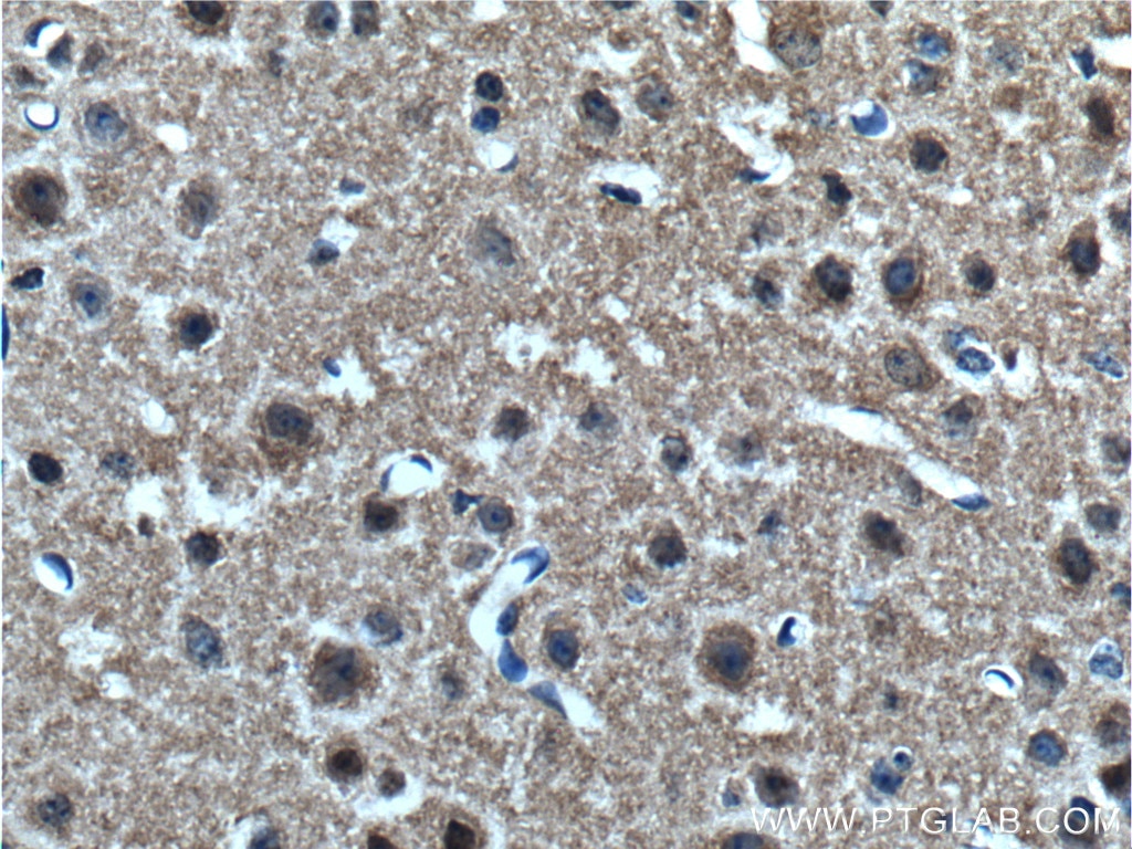 Immunohistochemistry (IHC) staining of mouse brain tissue using Alpha Synuclein Polyclonal antibody (10842-1-AP)