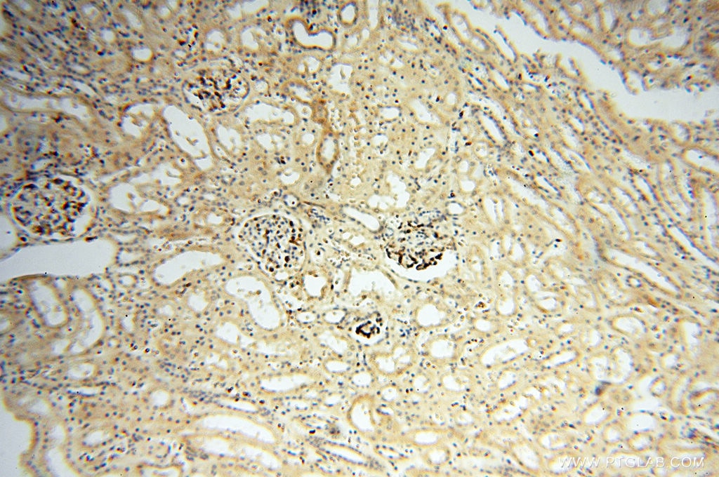 Immunohistochemistry (IHC) staining of human kidney tissue using Alpha Synuclein Polyclonal antibody (10842-1-AP)