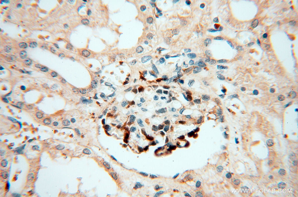 Immunohistochemistry (IHC) staining of human kidney tissue using Alpha Synuclein Polyclonal antibody (10842-1-AP)