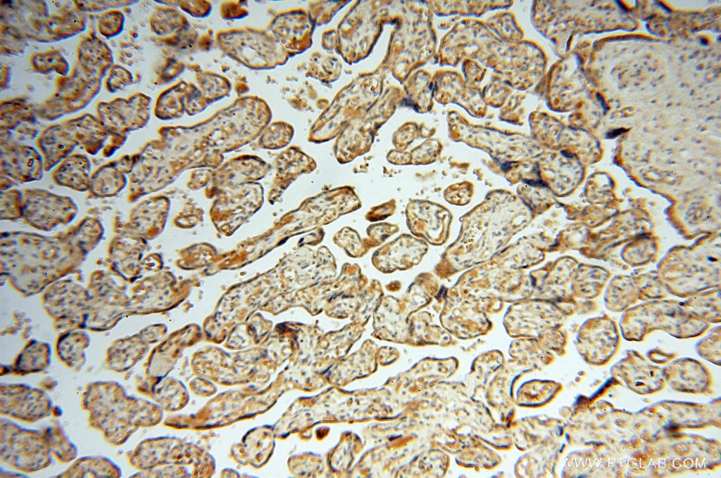 IHC staining of human placenta using 10842-1-AP