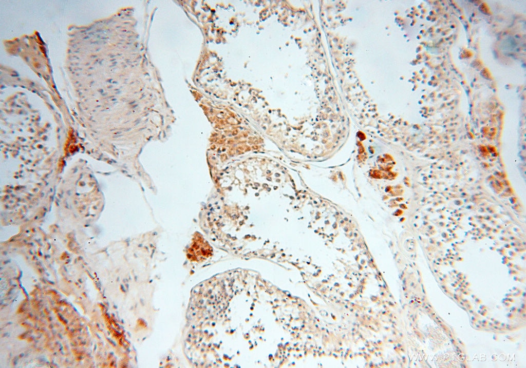 Immunohistochemistry (IHC) staining of human testis tissue using Alpha Synuclein Polyclonal antibody (10842-1-AP)