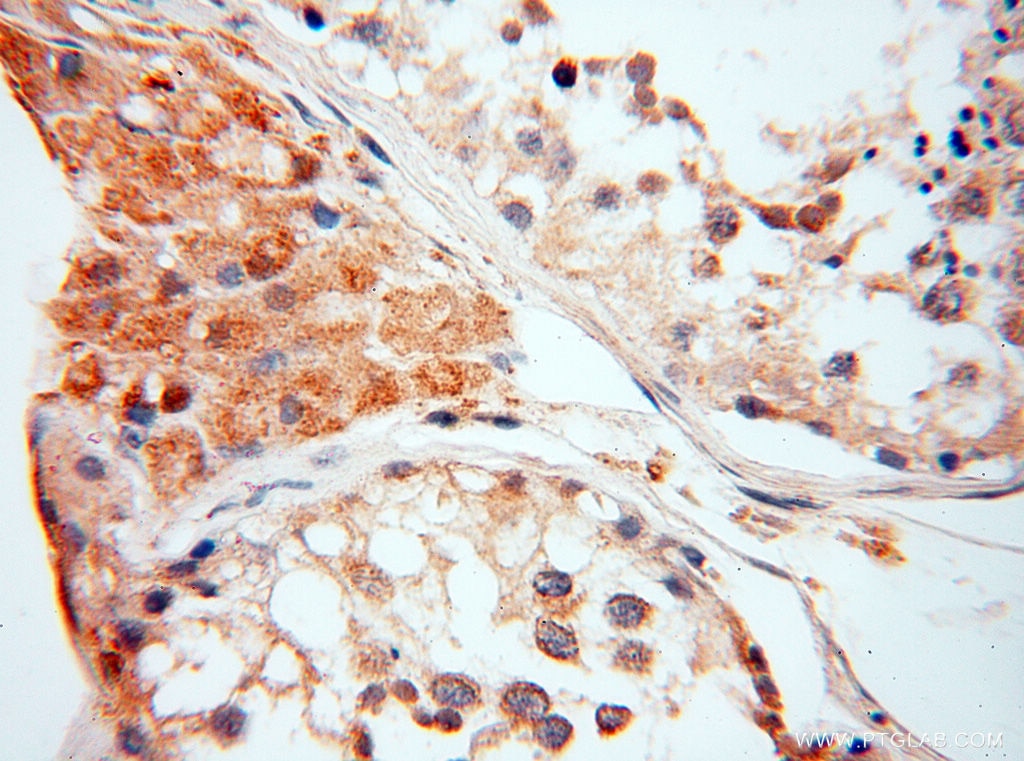 Immunohistochemistry (IHC) staining of human testis tissue using Alpha Synuclein Polyclonal antibody (10842-1-AP)
