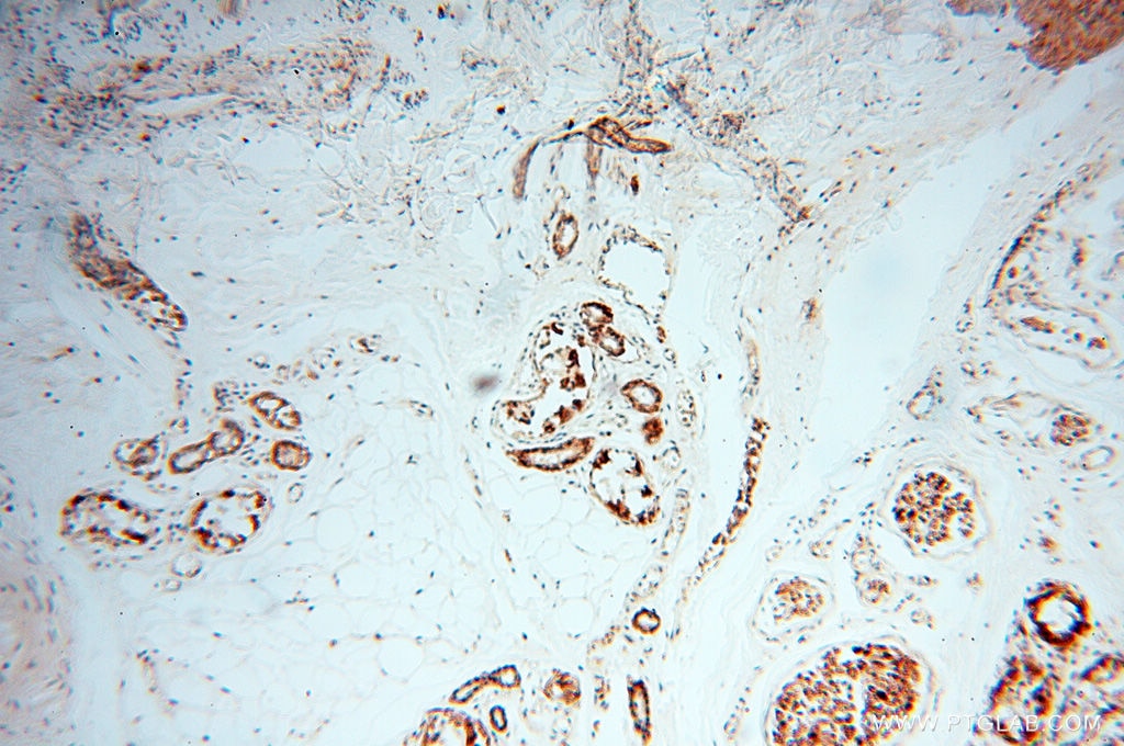 IHC staining of human skin using 10842-1-AP