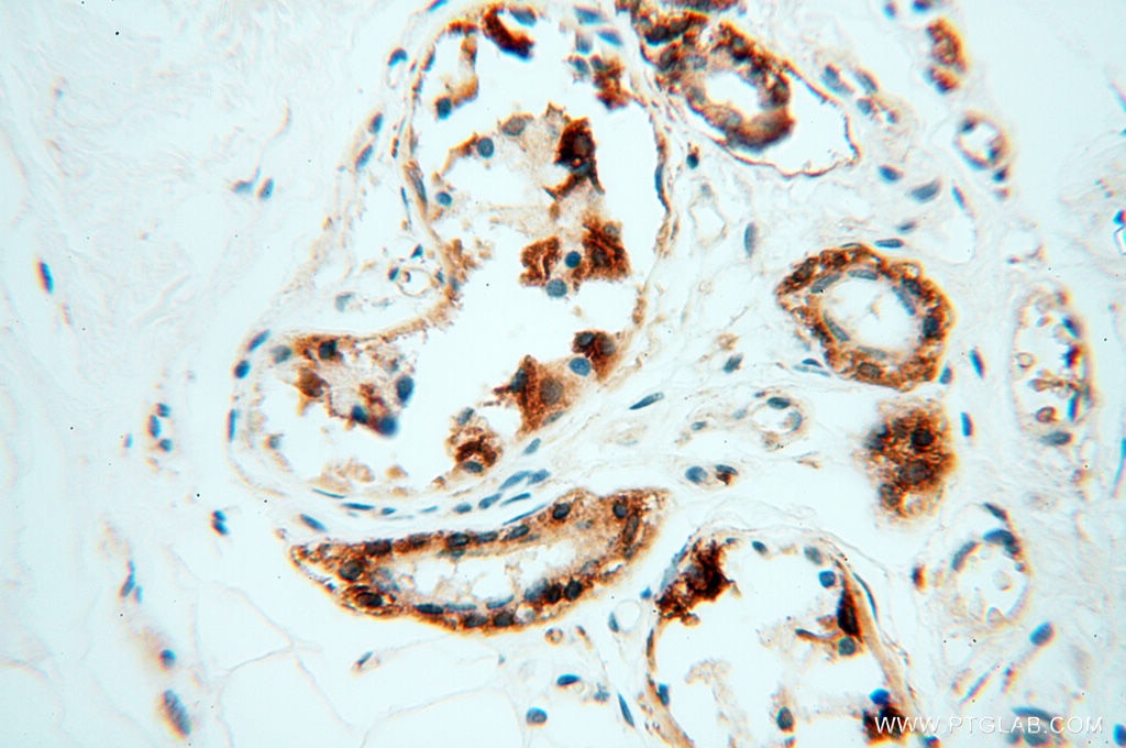 Immunohistochemistry (IHC) staining of human skin tissue using Alpha Synuclein Polyclonal antibody (10842-1-AP)