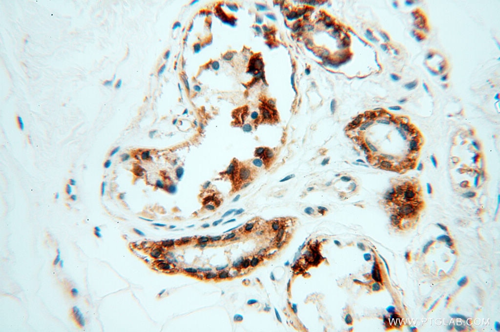 IHC staining of human skin using 10842-1-AP