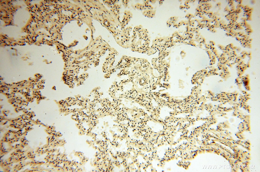 Immunohistochemistry (IHC) staining of human lung tissue using Alpha Synuclein Polyclonal antibody (10842-1-AP)