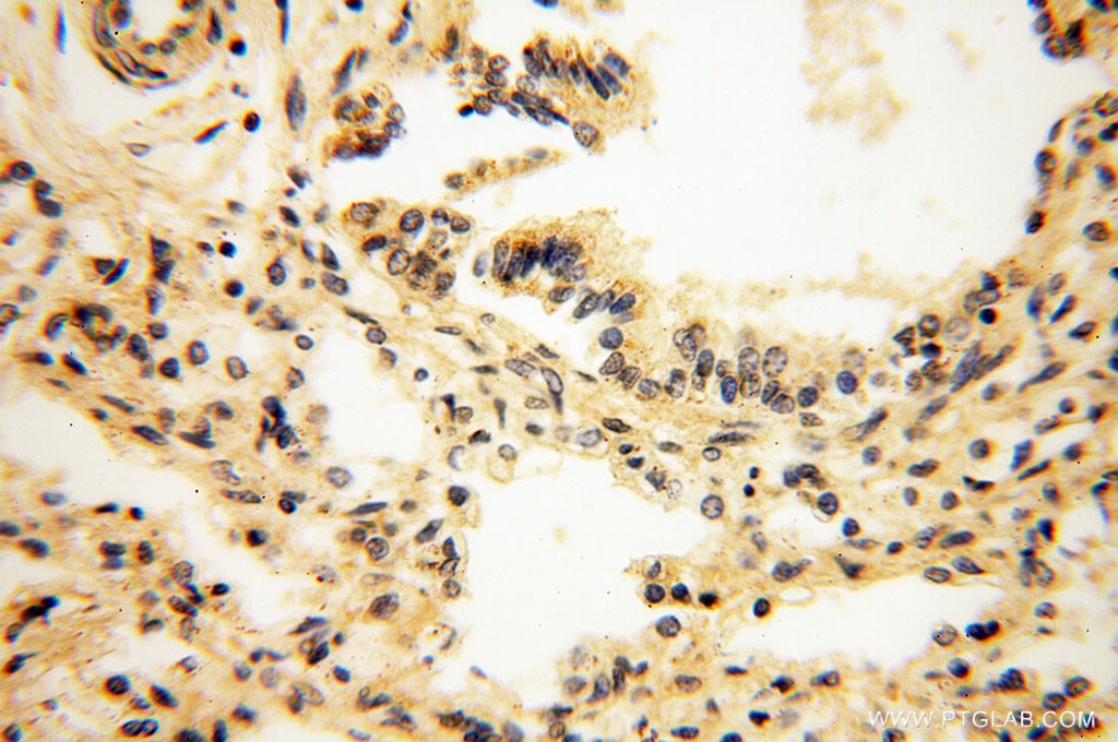 Immunohistochemistry (IHC) staining of human lung tissue using Alpha Synuclein Polyclonal antibody (10842-1-AP)