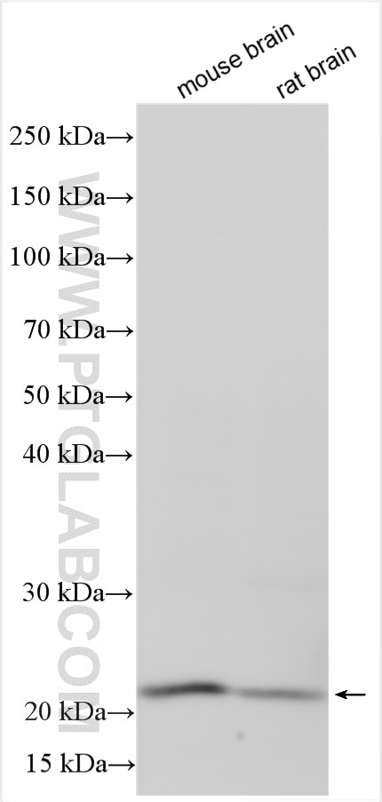 Western Blot (WB) analysis of various lysates using Alpha Synuclein Polyclonal antibody (10842-1-AP)