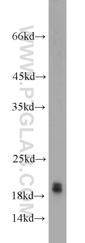 Alpha Synuclein Polyclonal antibody