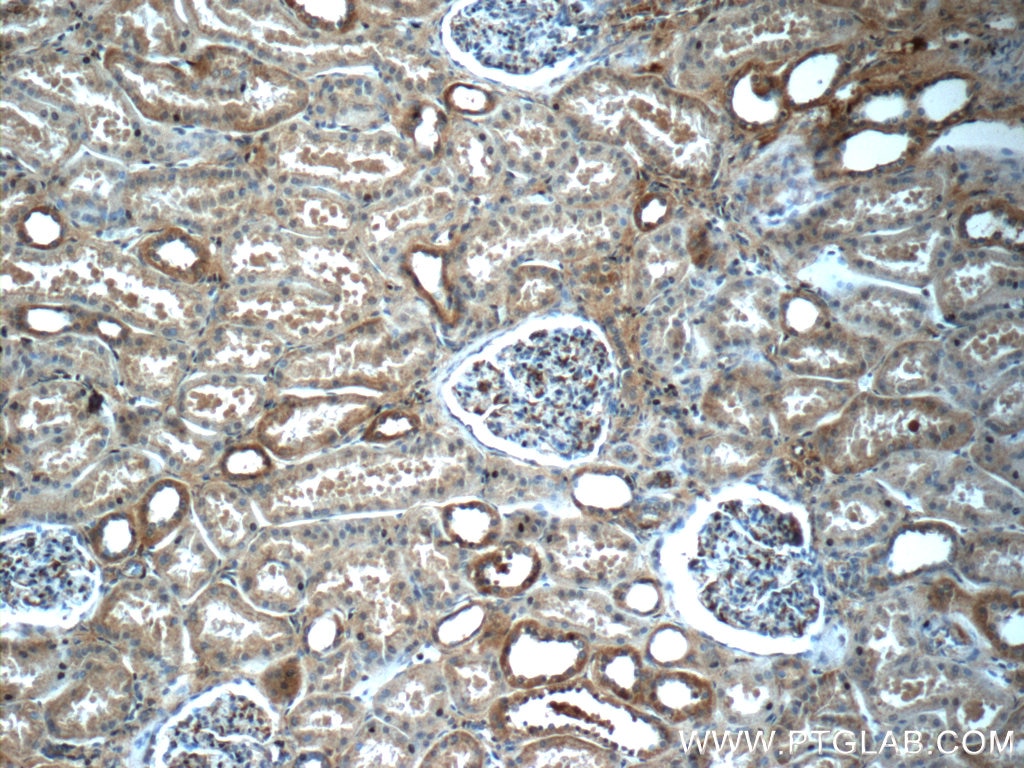 Immunohistochemistry (IHC) staining of human kidney tissue using SNCAIP Polyclonal antibody (17818-1-AP)