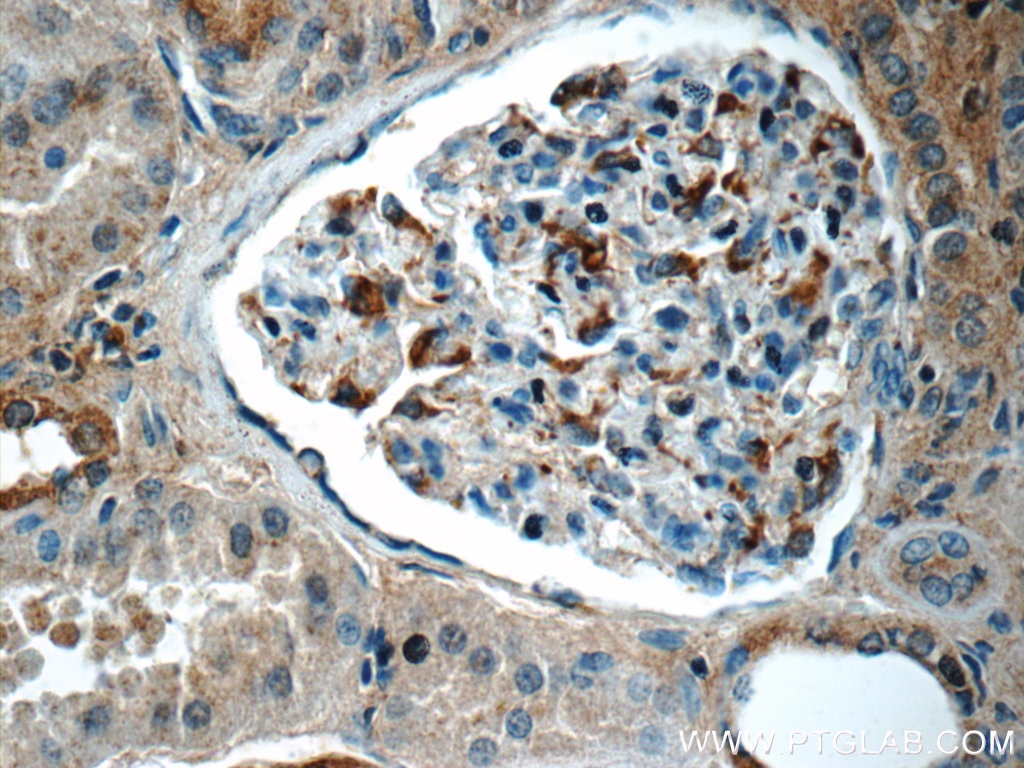 Immunohistochemistry (IHC) staining of human kidney tissue using SNCAIP Polyclonal antibody (17818-1-AP)