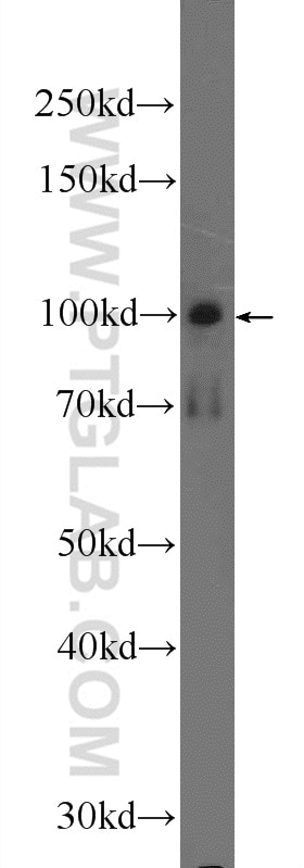 Western Blot (WB) analysis of mouse brain tissue using SNCAIP Polyclonal antibody (17818-1-AP)