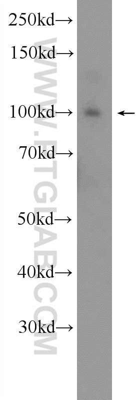 Western Blot (WB) analysis of fetal human brain tissue using SNCAIP Polyclonal antibody (17818-1-AP)