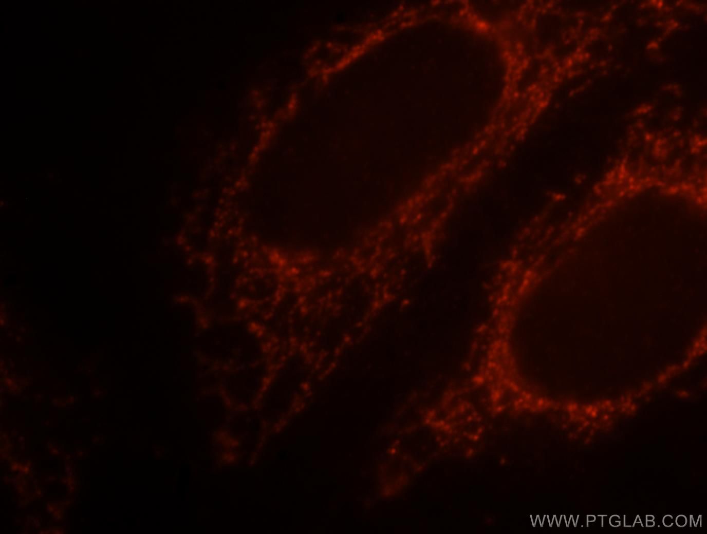 Immunofluorescence (IF) / fluorescent staining of HepG2 cells using SNCB Polyclonal antibody (10498-1-AP)