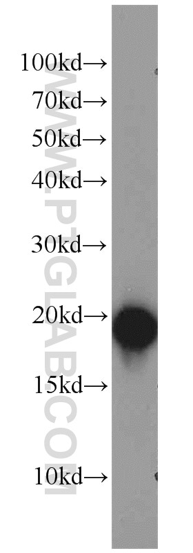 Western Blot (WB) analysis of rat brain tissue using SNCB Polyclonal antibody (10498-1-AP)