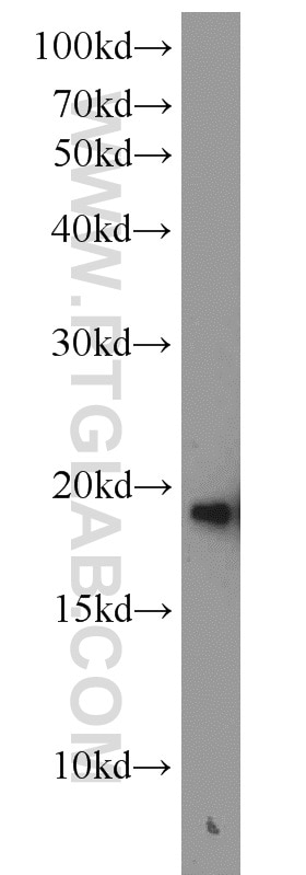 Western Blot (WB) analysis of mouse brain tissue using SNCB Polyclonal antibody (10498-1-AP)