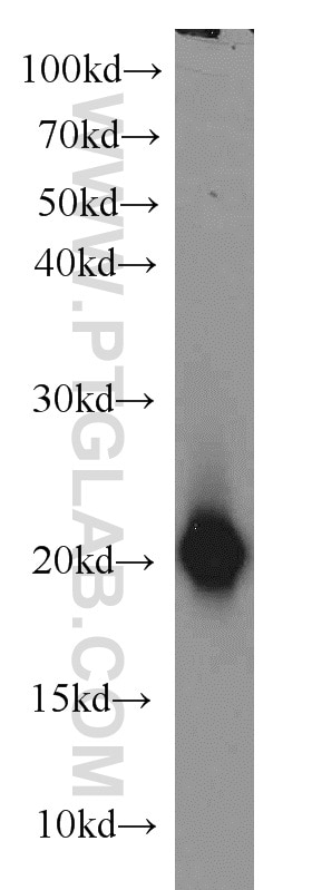 Western Blot (WB) analysis of mouse brain tissue using SNCB Polyclonal antibody (10498-1-AP)