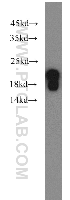 Western Blot (WB) analysis of mouse brain tissue using SNCB Polyclonal antibody (10498-1-AP)