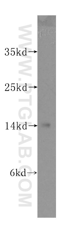 Western Blot (WB) analysis of human brain tissue using SNCB Polyclonal antibody (10498-1-AP)