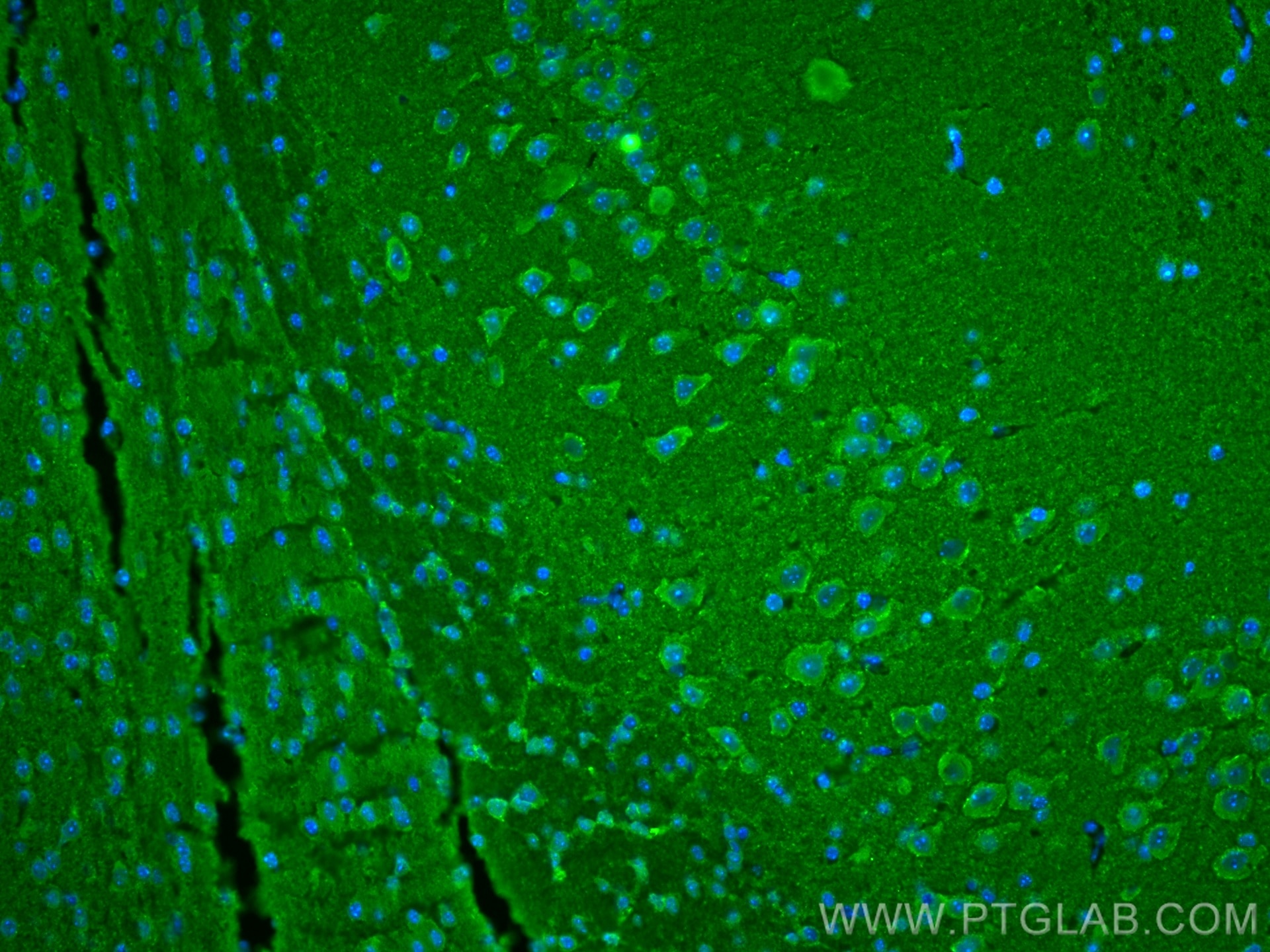 Immunofluorescence (IF) / fluorescent staining of mouse brain tissue using SNCB Monoclonal antibody (68046-1-Ig)