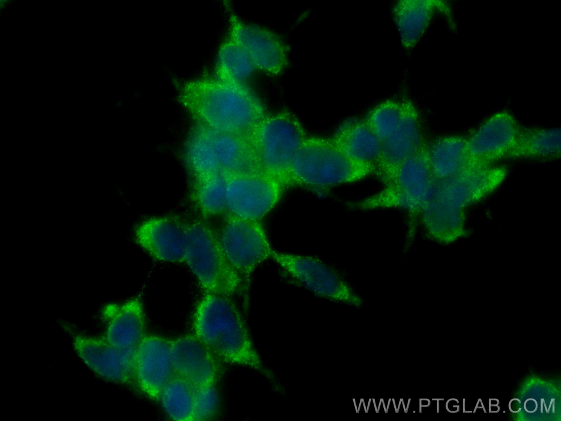 Immunofluorescence (IF) / fluorescent staining of SH-SY5Y cells using CoraLite® Plus 488-conjugated SNCB Monoclonal anti (CL488-68046)