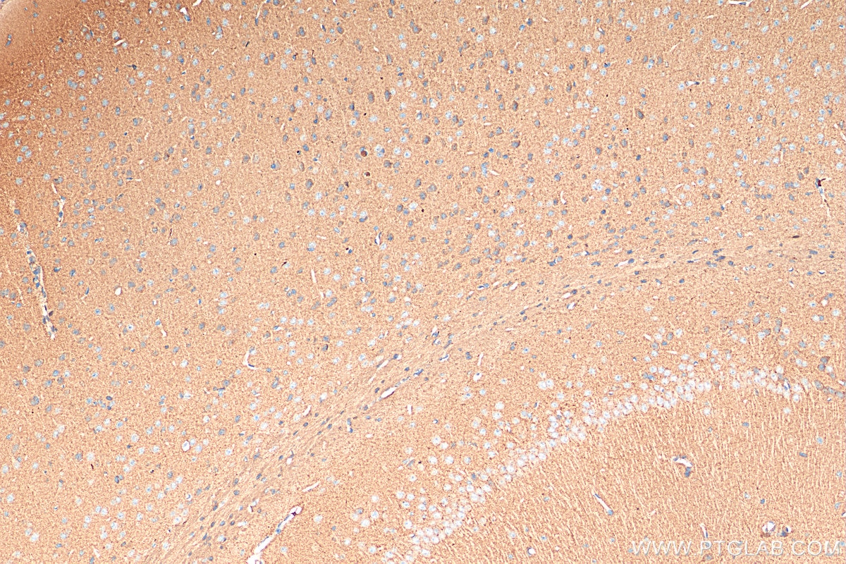 Immunohistochemistry (IHC) staining of mouse brain tissue using SNCG Polyclonal antibody (16398-1-AP)