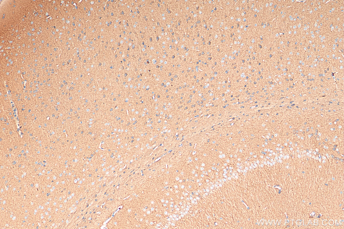 Immunohistochemistry (IHC) staining of mouse brain tissue using SNCG Polyclonal antibody (16398-1-AP)