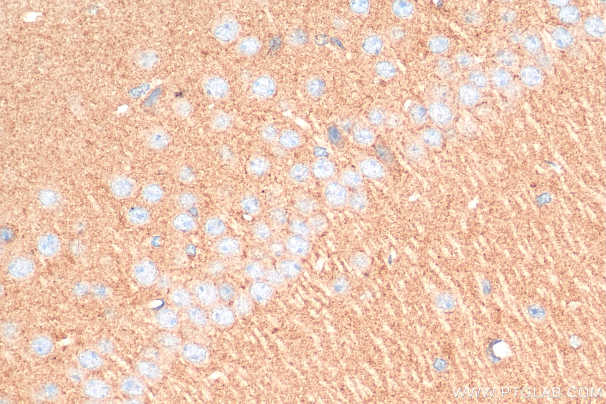 Immunohistochemistry (IHC) staining of mouse brain tissue using SNCG Polyclonal antibody (16398-1-AP)