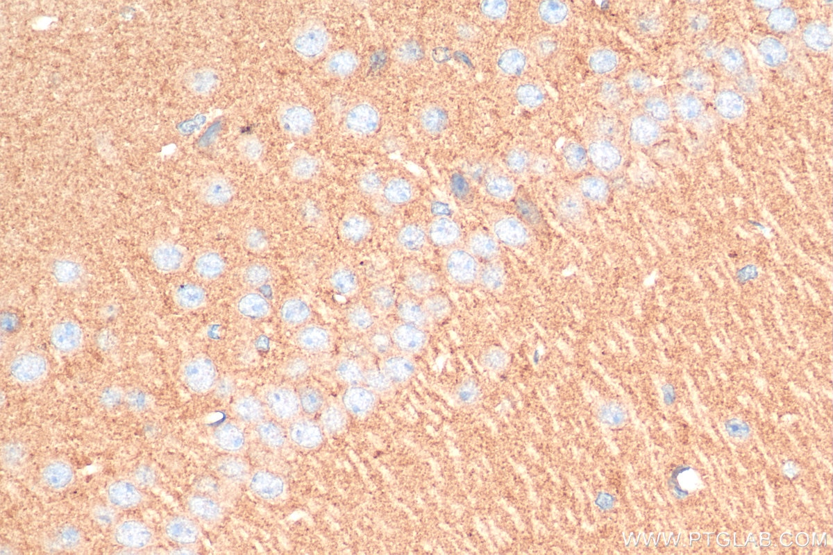 Immunohistochemistry (IHC) staining of mouse brain tissue using SNCG Polyclonal antibody (16398-1-AP)