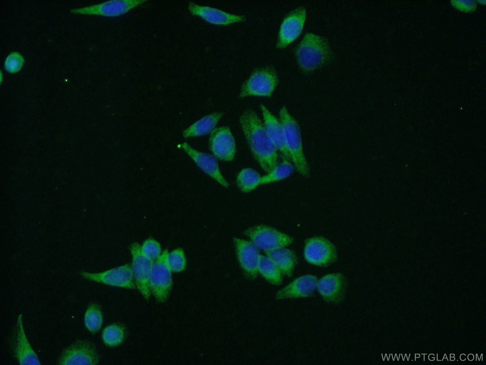 Immunofluorescence (IF) / fluorescent staining of HeLa cells using SND1 Polyclonal antibody (10760-1-AP)