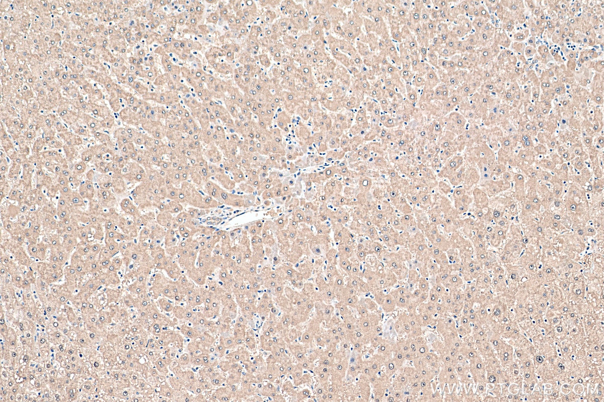 Immunohistochemistry (IHC) staining of human liver tissue using SND1 Polyclonal antibody (10760-1-AP)