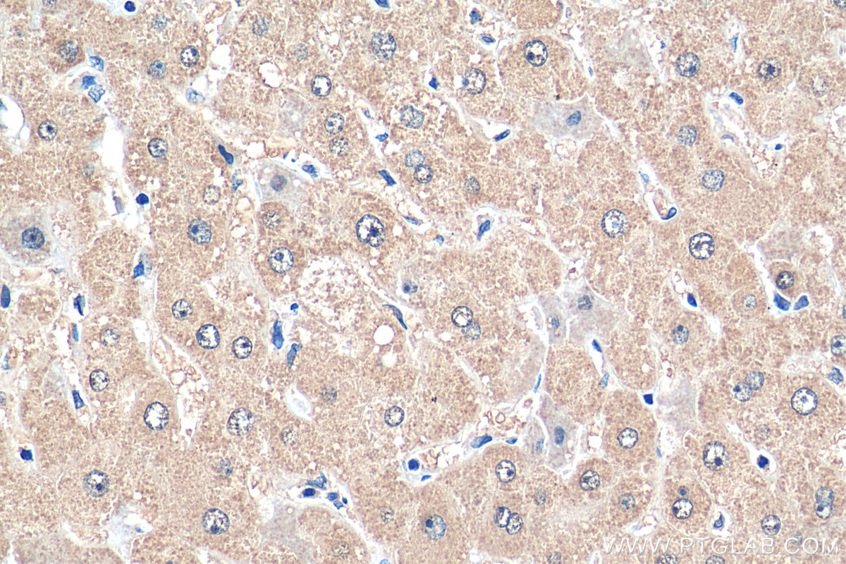 Immunohistochemistry (IHC) staining of human liver tissue using SND1 Polyclonal antibody (10760-1-AP)