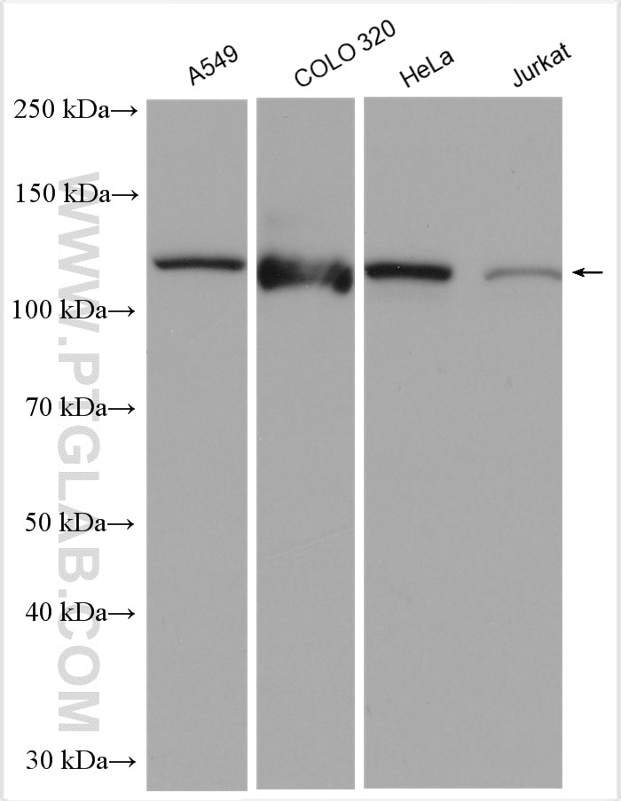 Western Blot (WB) analysis of various lysates using SND1 Polyclonal antibody (10760-1-AP)