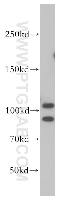 SND1 Polyclonal antibody