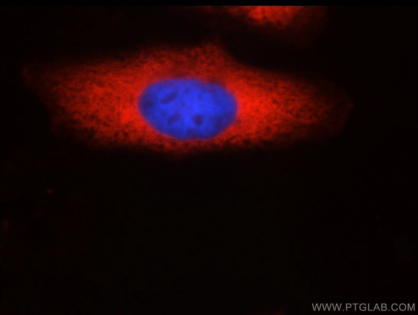 Immunofluorescence (IF) / fluorescent staining of HepG2 cells using SND1 Monoclonal antibody (60265-1-Ig)
