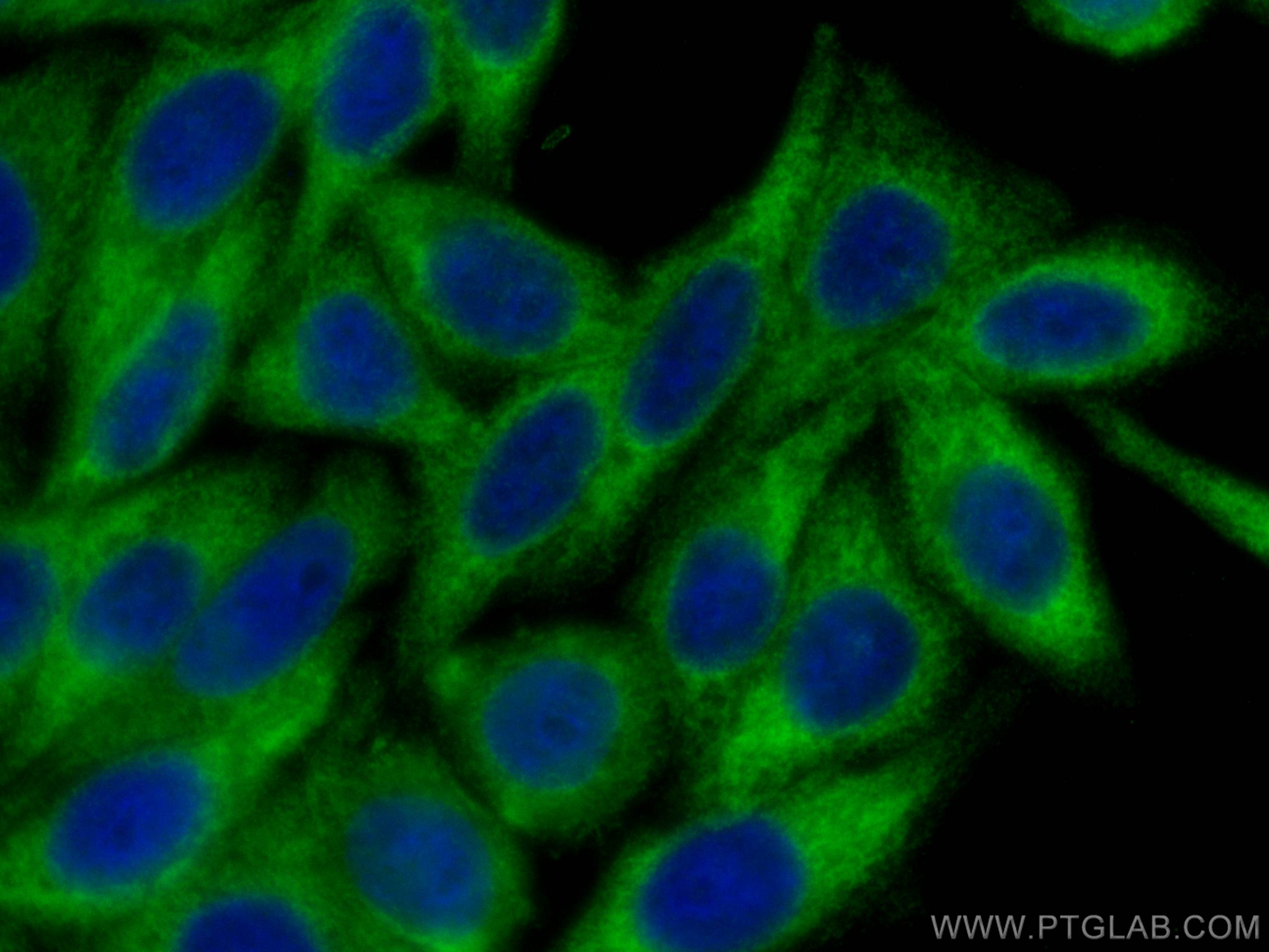 Immunofluorescence (IF) / fluorescent staining of HepG2 cells using SND1 Monoclonal antibody (60265-1-Ig)