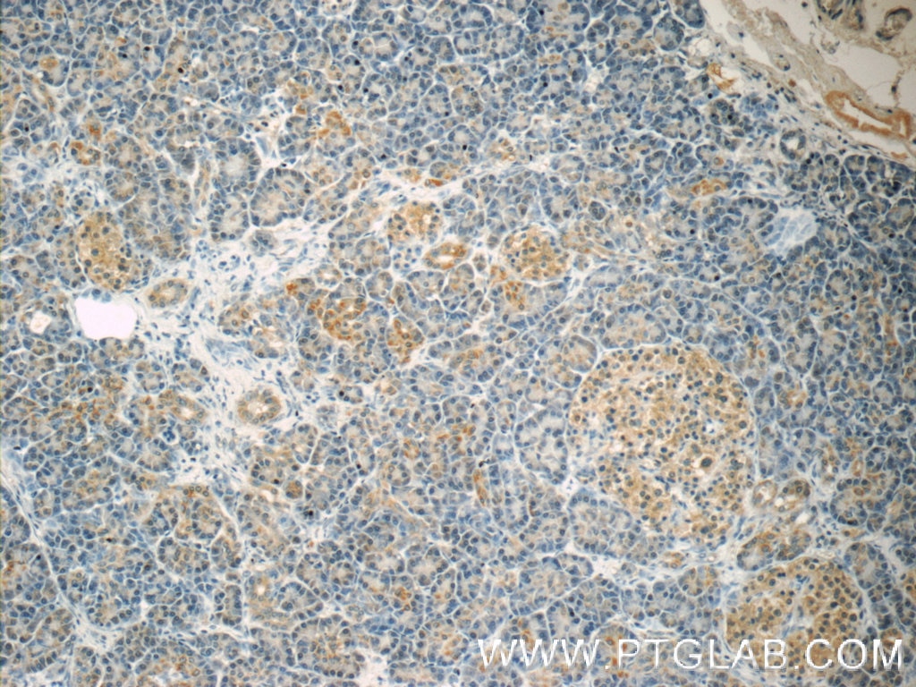 Immunohistochemistry (IHC) staining of human pancreas tissue using SND1 Monoclonal antibody (60265-1-Ig)