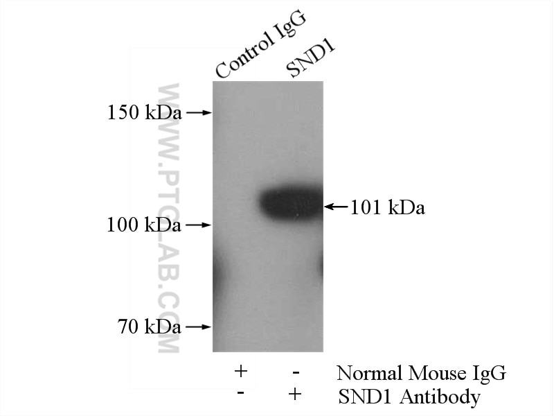 Immunoprecipitation (IP) experiment of HeLa cells using SND1 Monoclonal antibody (60265-1-Ig)