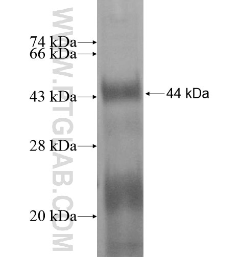 SNED1 fusion protein Ag15417 SDS-PAGE