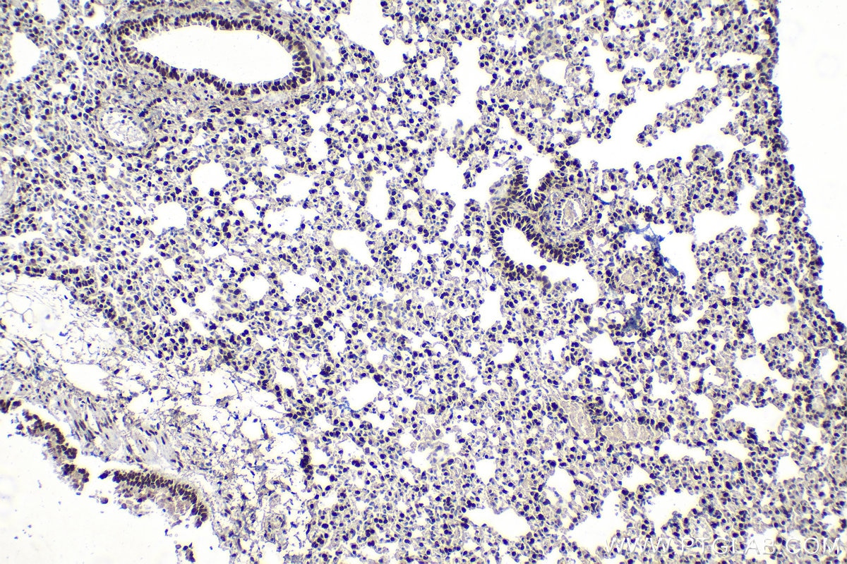Immunohistochemistry (IHC) staining of mouse lung tissue using SNF2L Polyclonal antibody (29461-1-AP)
