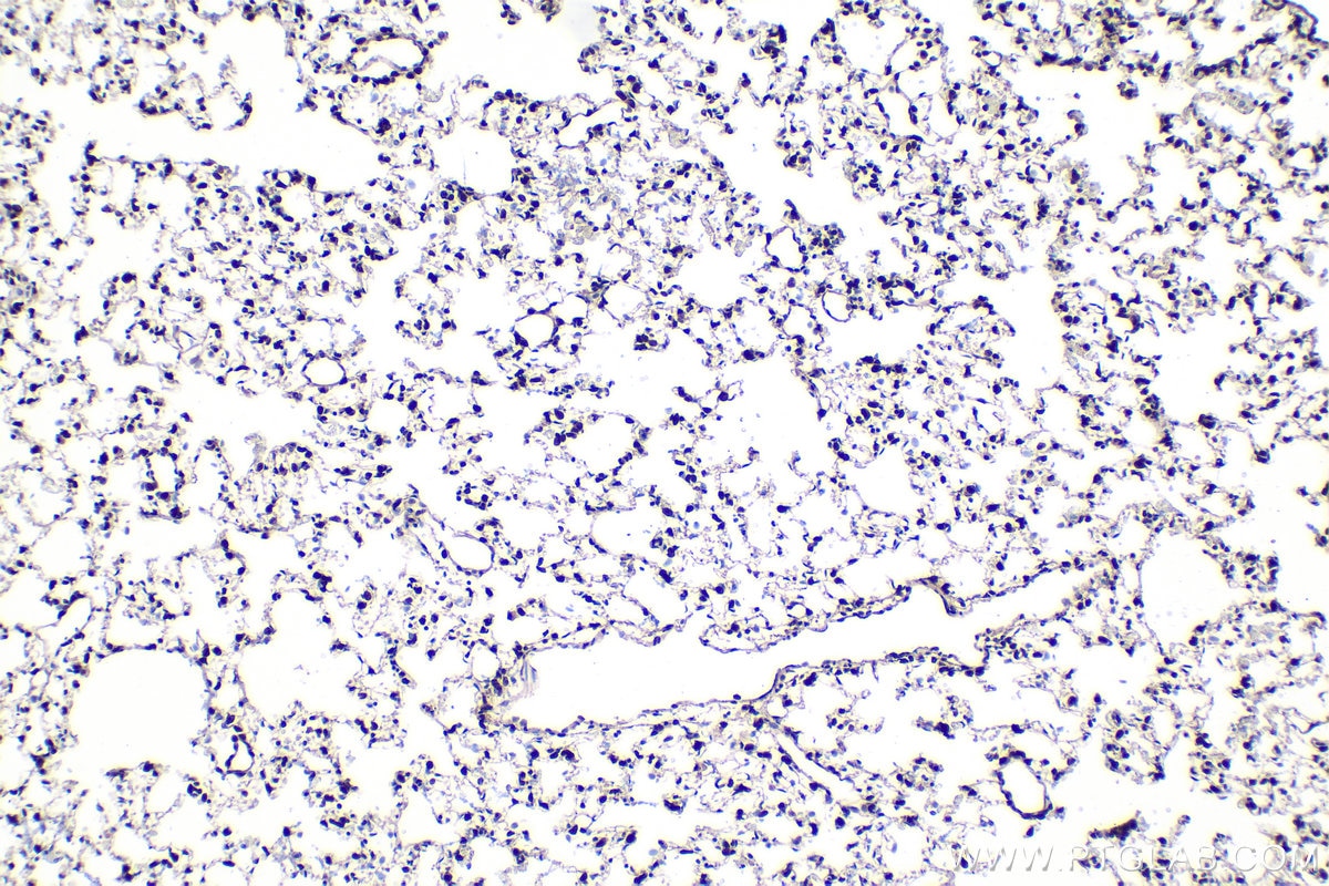 Immunohistochemistry (IHC) staining of rat lung tissue using SNF2L Polyclonal antibody (29461-1-AP)