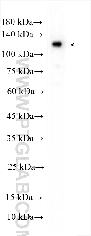 Western Blot (WB) analysis of U-251 cells using SNF2L Polyclonal antibody (29461-1-AP)