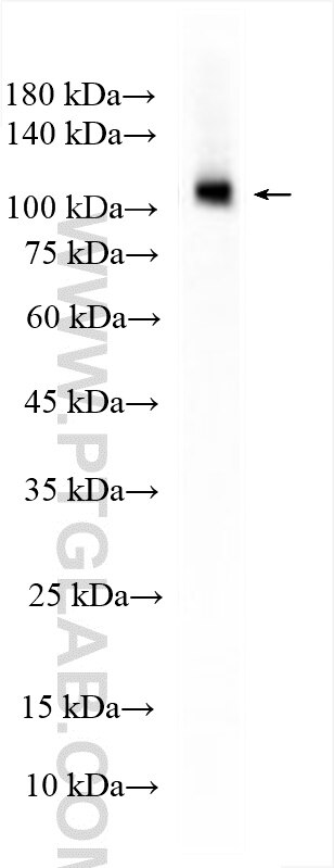 WB analysis of SH-SY5Y using 29461-1-AP